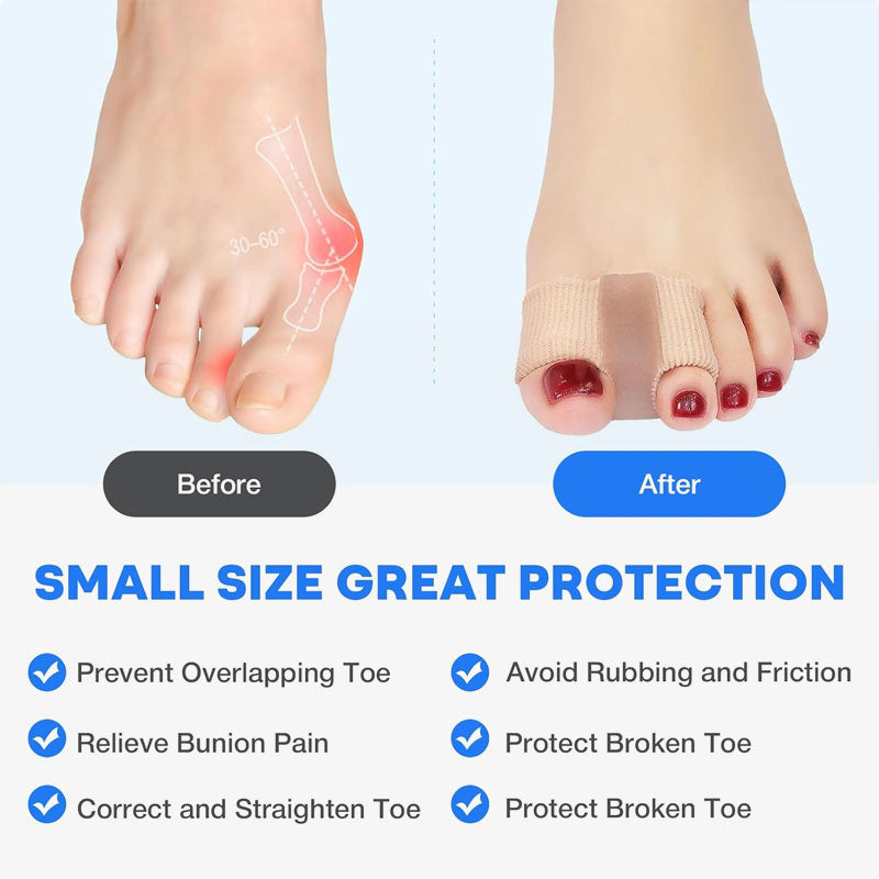 Bunion Relief Toe Separator